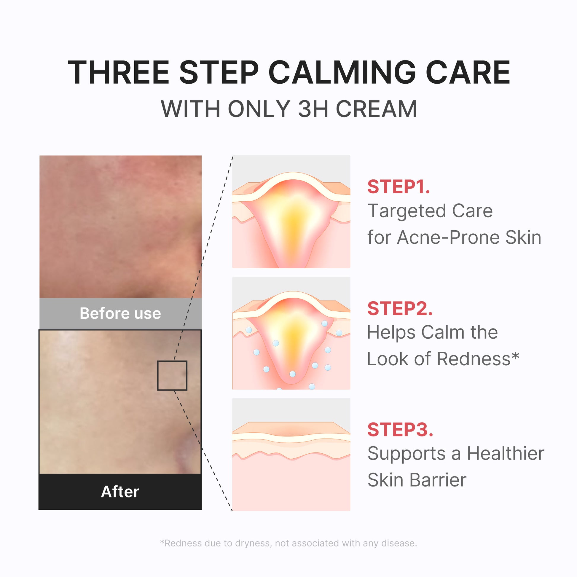 3H Daily Relief Cream - medicube.us