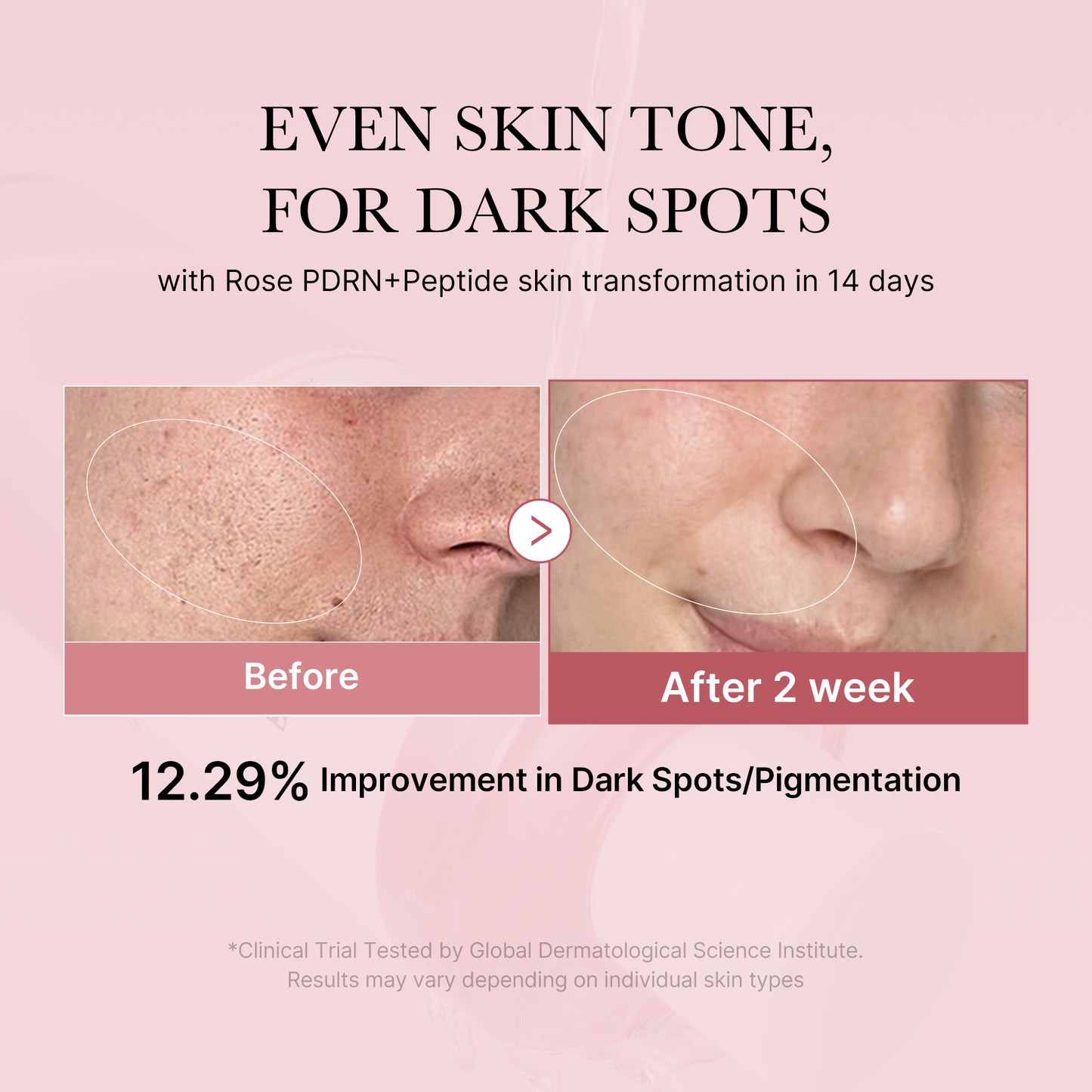 PDRN Pink Peptide Toner - medicube.us
