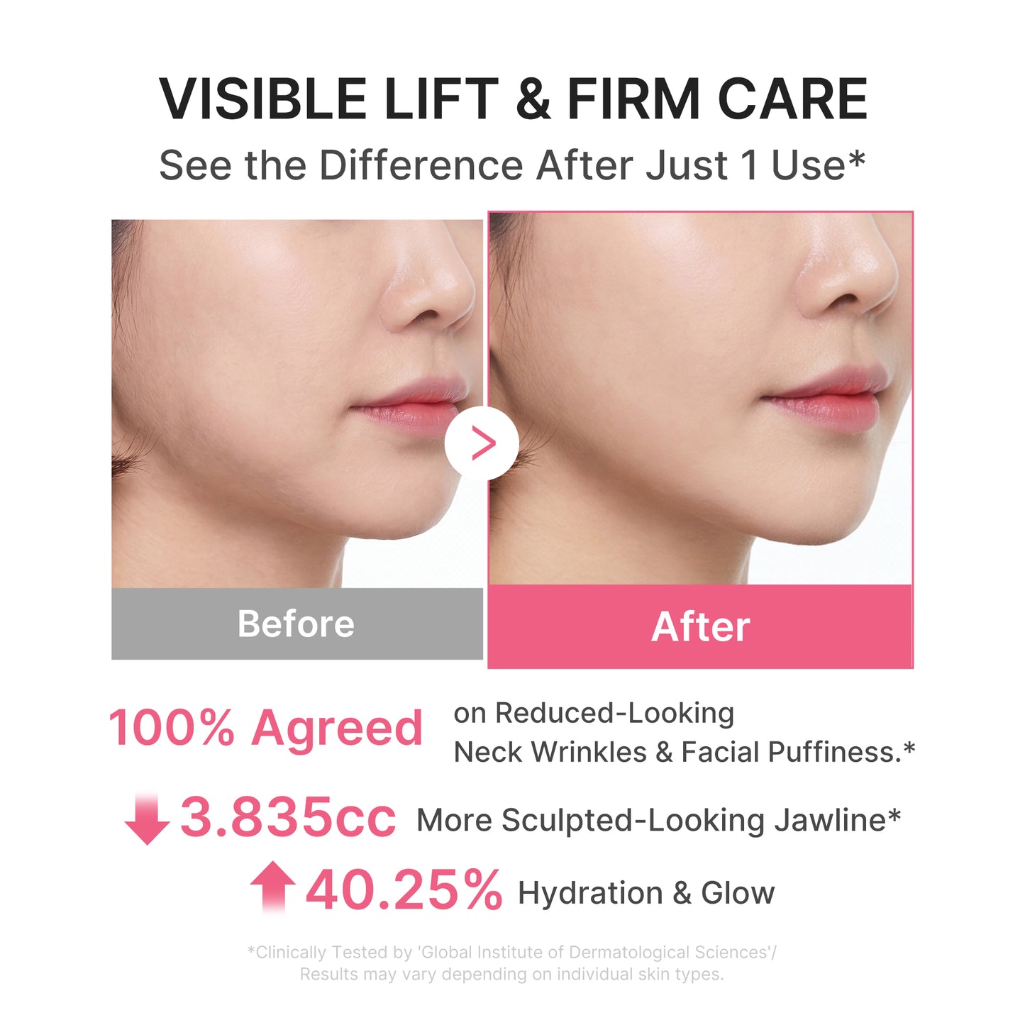 PDRN Collagen Gua Sha Neck Wrinkle Cream - medicube.us